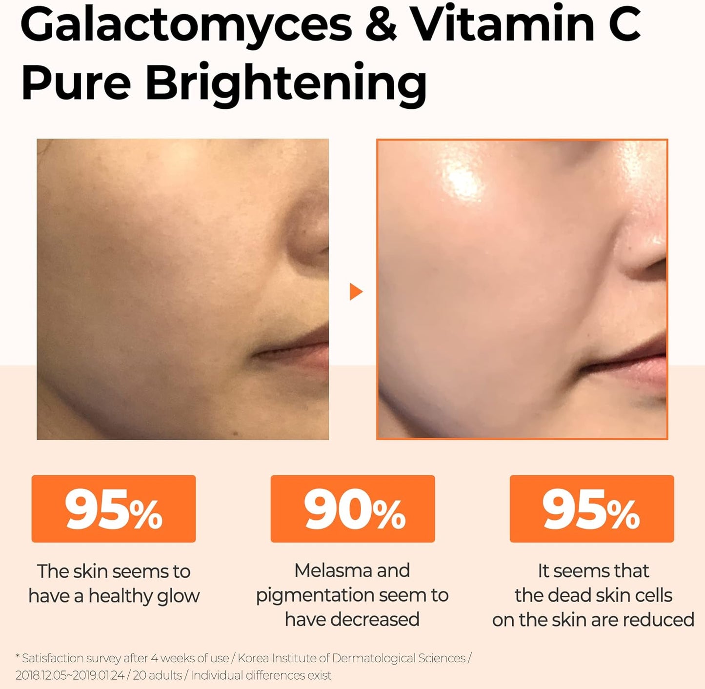 Some By Mi Galactomyces Pure Vitamin C Glow Serum 30ml